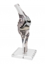Kniemodell mit Endoprothese