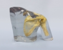 Röntgenphantom Schulter, transparent