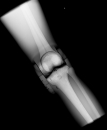 Röntgen-Teilphantom mit künstlichen Knochen - Rechtes Knie, transparent