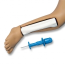 Intraoss&auml;re Infusion f&uuml;r R17710