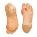 Häufige Fußprobleme (R10035)