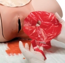 Postpartum Hemorrhage Trainer, PPH Trainer P97