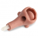 Ersatz f&uuml;r erweiterten Atemweg