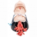 AirSim Combo Bronchi X