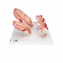 Schwangerschaftsmodell Serie, 5 Modelle - 3B Smart Anatomy