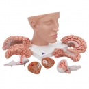 Menschliches Gehirnmodell mit Arterien auf Kopfbasis, 8-teilig - 3B Smart Anatomy
