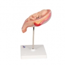 Fetus Modell, 5. Monat, Steißlage