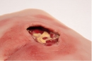 Wundmoulage sakraler Dekubitus, gesäubert