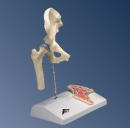 Mini-Hüftgelenk mit Querschnitt