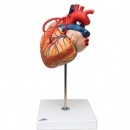 Herz mit Bypass, 2-fache Größe, 4-teilig