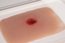 Wundmoulage Einschußwunde