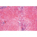 Pathologische Histologie des Menschen - Deutsch