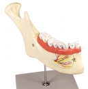 Unterkiefer, 6 Teile