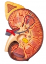 Nierenschnitt, Nephron und Nierenkörperchen