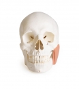 Schädelmodell für Zahnmedizin mit CMD Syndrom, 8-teilig