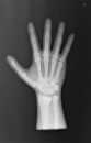 Röntgen-Teilphantom mit künstlichen Knochen - Rechte Hand, transparent