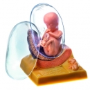 Menschlicher Embryo im 3. Monat (MS 11/3)