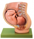 Becken mit Uterus im 9. Schwangerschaftsmonat (MS 13)