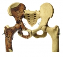 Beckenrekonstruktion von Australopithecus africanus (S 5/STs14)