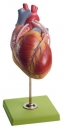 Herzmodell mit Bypassgefäßen (aortakoronarer Venenbypass) (HS 15/1)