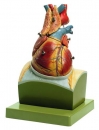 Herz auf Zwerchfellsockel (HS 22)