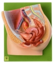 Medianschnitt des weiblichen Beckens (MS 1)