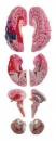Neuroanatomie-Kopfmodell (QS 65/7)