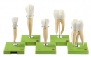 Fünf Zahnmodelle (ES 11)