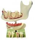 Unterkiefer eines Achtzehnjährigen (ES 4)