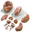Gehirn mit Arterien (BS 23)