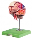 Gehirn mit Arterien, Falx cerebri und farbl. Markierung der Rind (BS 23/4)
