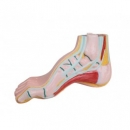 Hohlfu&szlig;, pes cavus