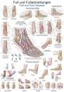 Lehrtafel Fuß und Fußerkrankungen (AL128)