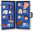 Die Folgen des Alkoholmissbrauchs - 3D-Display
