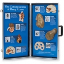 Die Folgen des Drogenmissbrauchs - 3D-Display